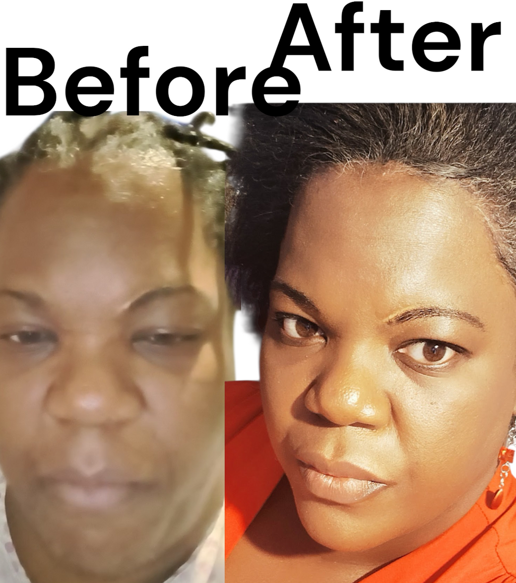 Skin lightening Soap.